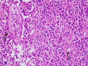 Cancer Cells Glow and Die